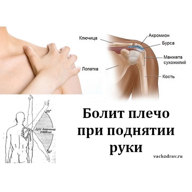 БОЛИТ ПЛЕЧО ПРИ ПОДНЯТИИ РУКИ?