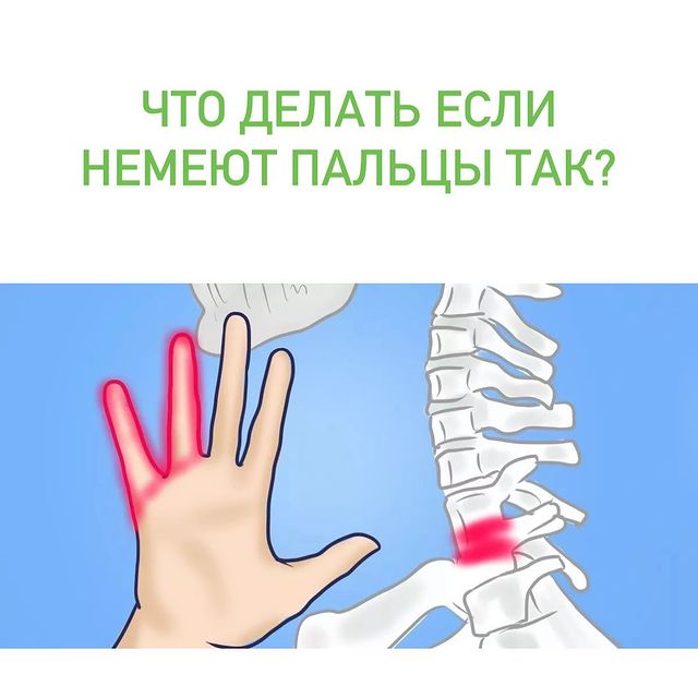 ЧТО ДЕЛАТЬ ЕСЛИ НЕМЕЮТ ПАЛЬЦЫ ТАК?