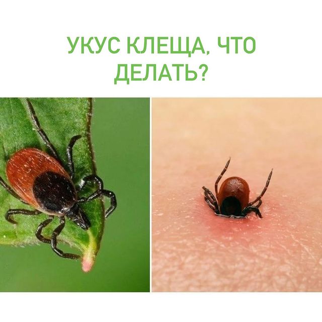 УКУС КЛЕЩА