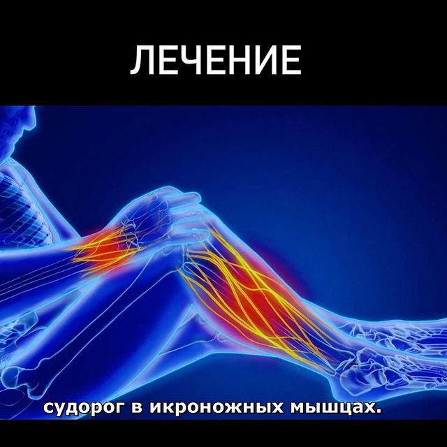 ЛЕЧЕНИЕ СУДОРОГ В ИКРОНОЖНЫХ МЫШЦАХ.