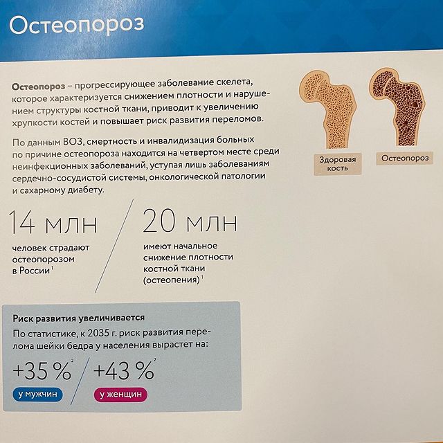 ОСТЕОПОРОЗ - снижение минеральной плотности костной ткани.